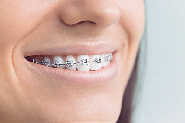 Best Full Mouth Reconstruction  in Mickleton, NJ